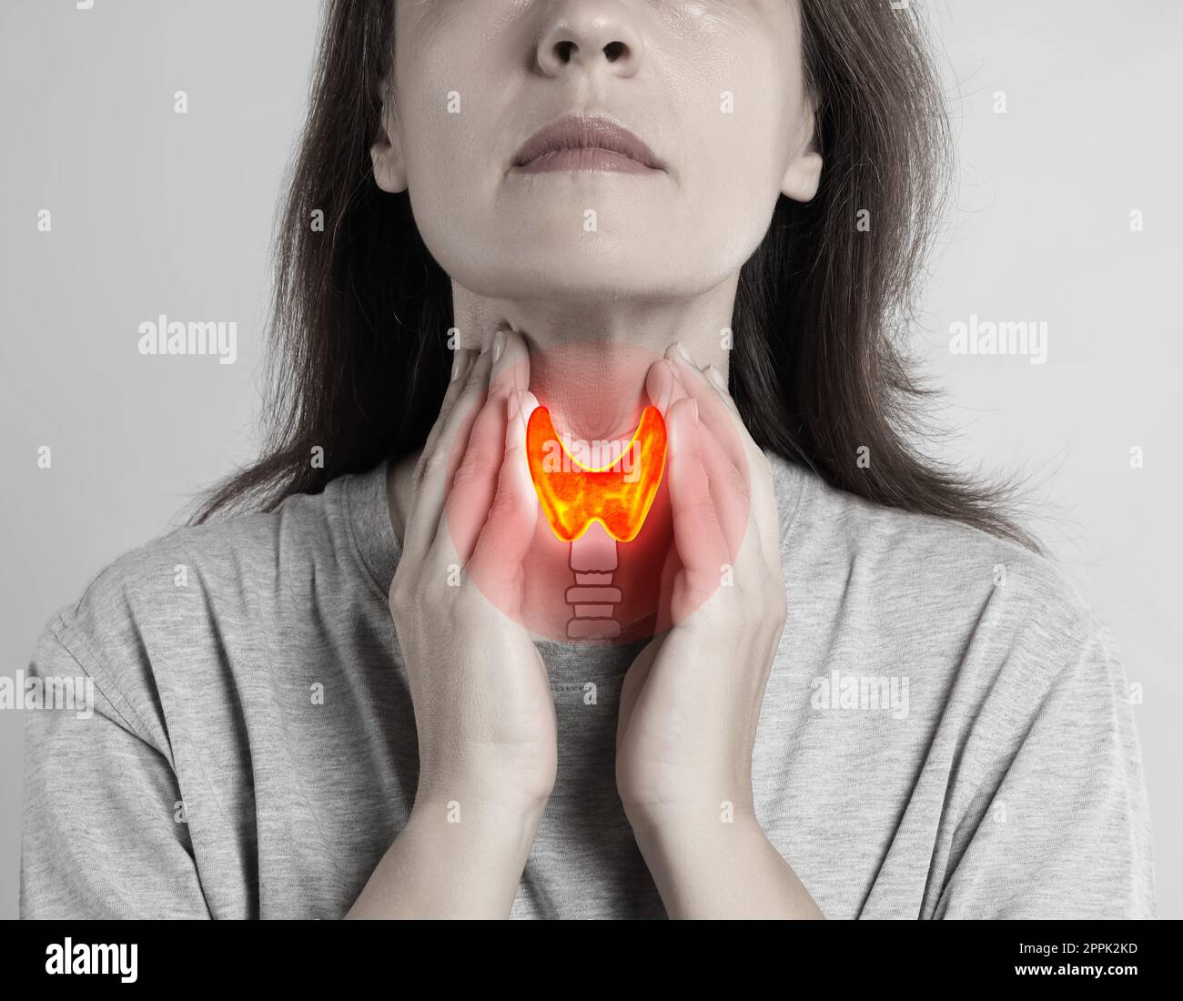 Donna e illustrazione della ghiandola tiroidea su sfondo grigio Foto Stock