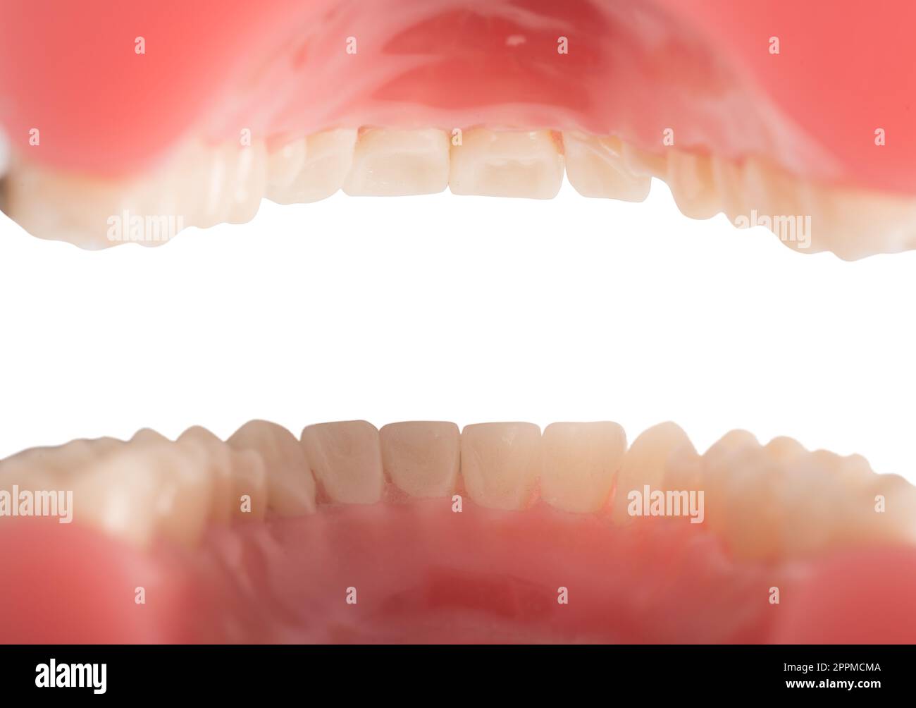 All'interno di una bocca aperta di un paziente dentista Foto Stock