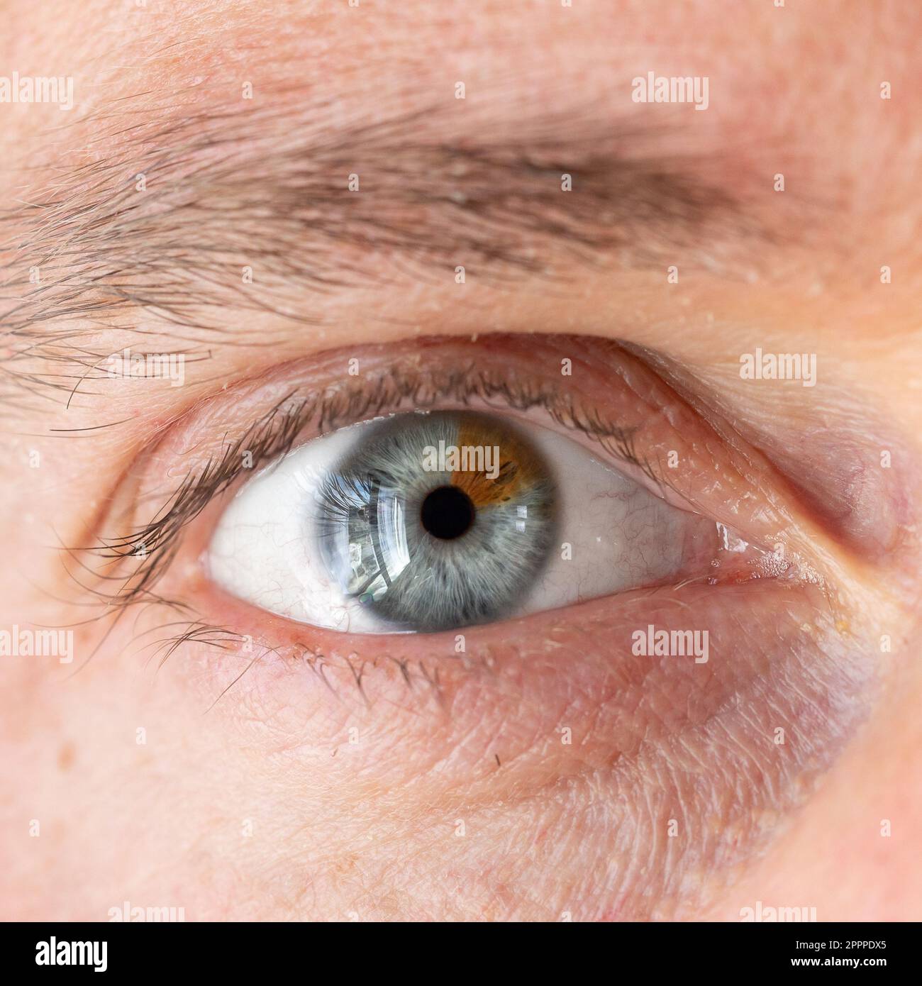Macro di un occhio umano con eterocromia. Estremo primo piano dell'occhio umano di due diversi colori: Blu e marrone Foto Stock