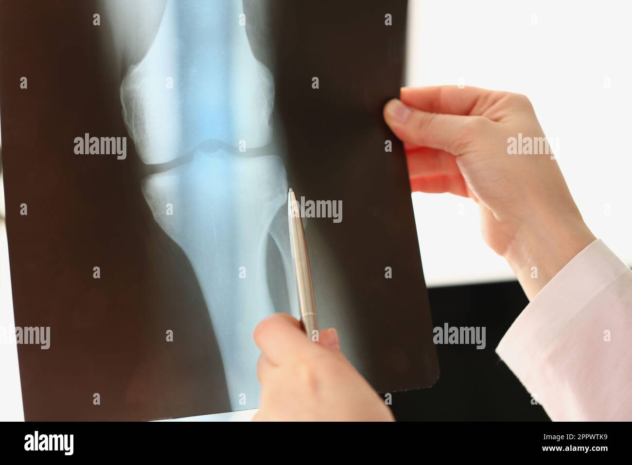 Il medico di sesso femminile guarda la radiografia di lesioni al ginocchio in ospedale Foto Stock