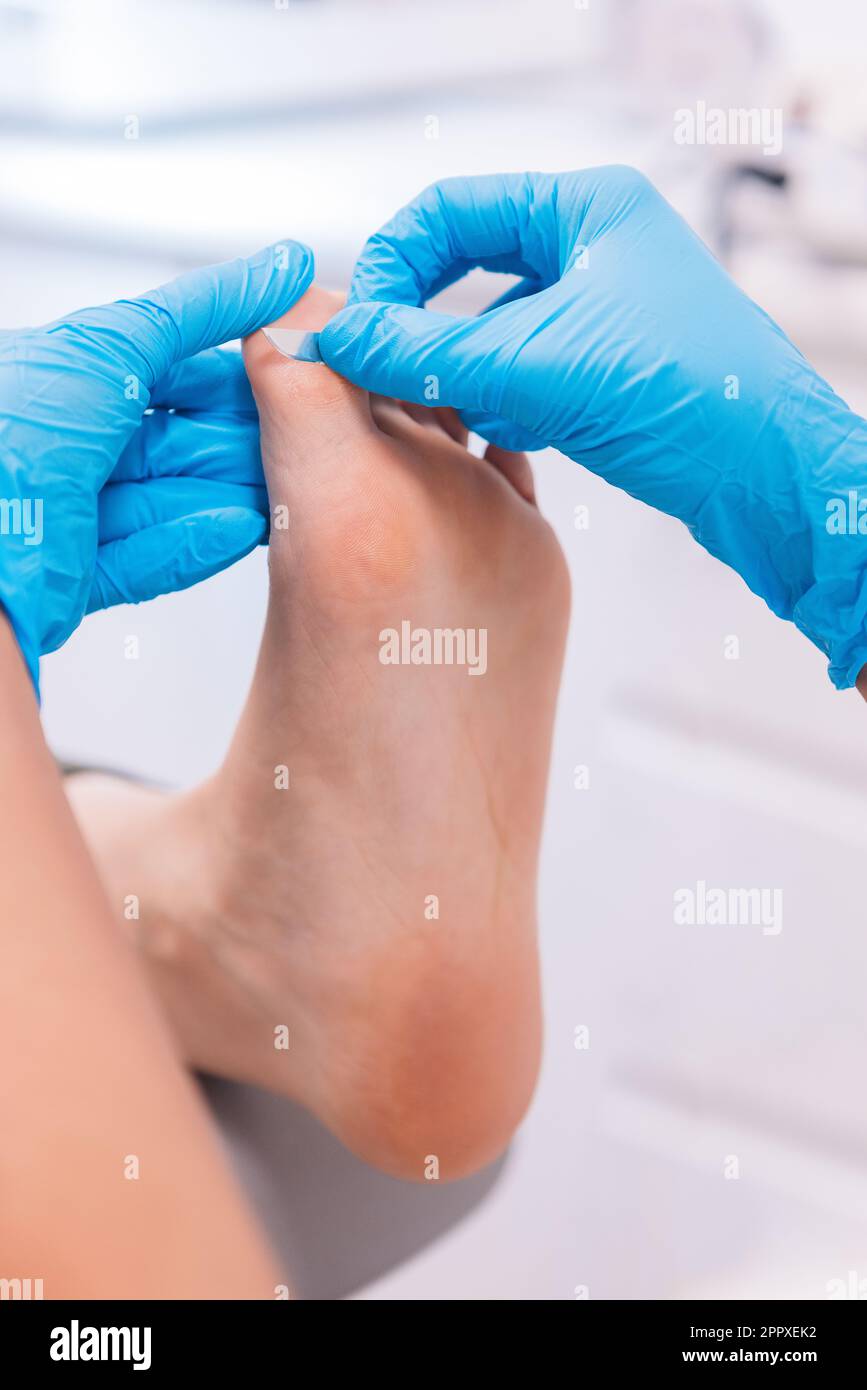 Medico professionista anonimo in guanti di lattice applicare patch sulle dita del paziente dopo l'intervento chirurgico in clinica moderna luce Foto Stock