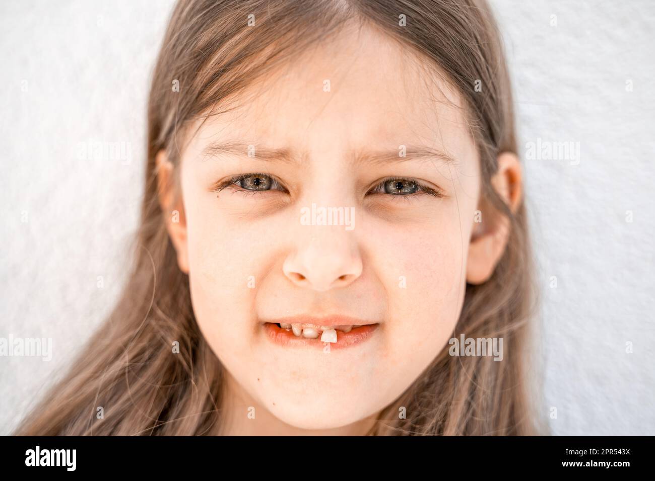 Affascinante ragazzina sorridente con la bocca aperta mostra sconcertante sciolto cadere fuori il primo dente anteriore del latte del bambino. Sostituzione dei denti del diffusore. Sano Foto Stock