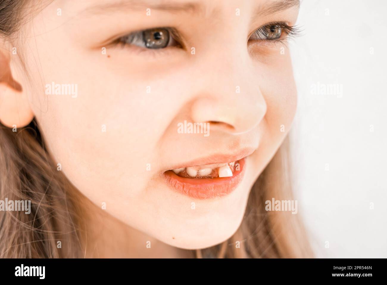 Affascinante ragazzina sorridente con la bocca aperta mostra sconcertante sciolto cadere fuori il primo dente anteriore del latte del bambino. Sostituzione dei denti del diffusore. Sano Foto Stock