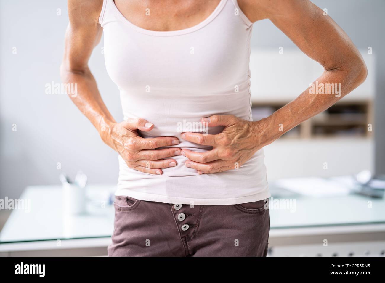Polipi intestinali e malattia del cancro del colon Foto Stock