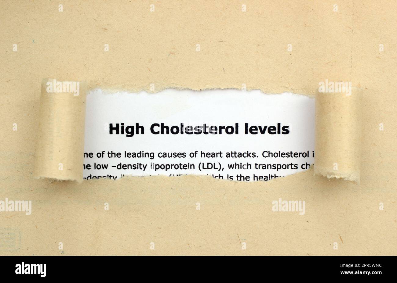 Elevati livelli di colesterolo Foto Stock