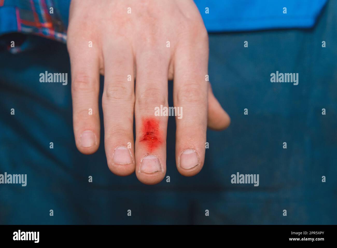 Tagliare a sangue, ferite alle dita, sangue della ferita, primo piano delle mani. Foto Stock