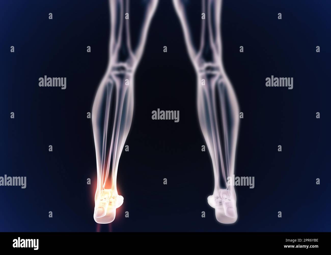 Angolatura e dolori articolari. Quando colpisce l'infiammazione. Illustrazione del corpo umano che indica la struttura scheletrica. Foto Stock