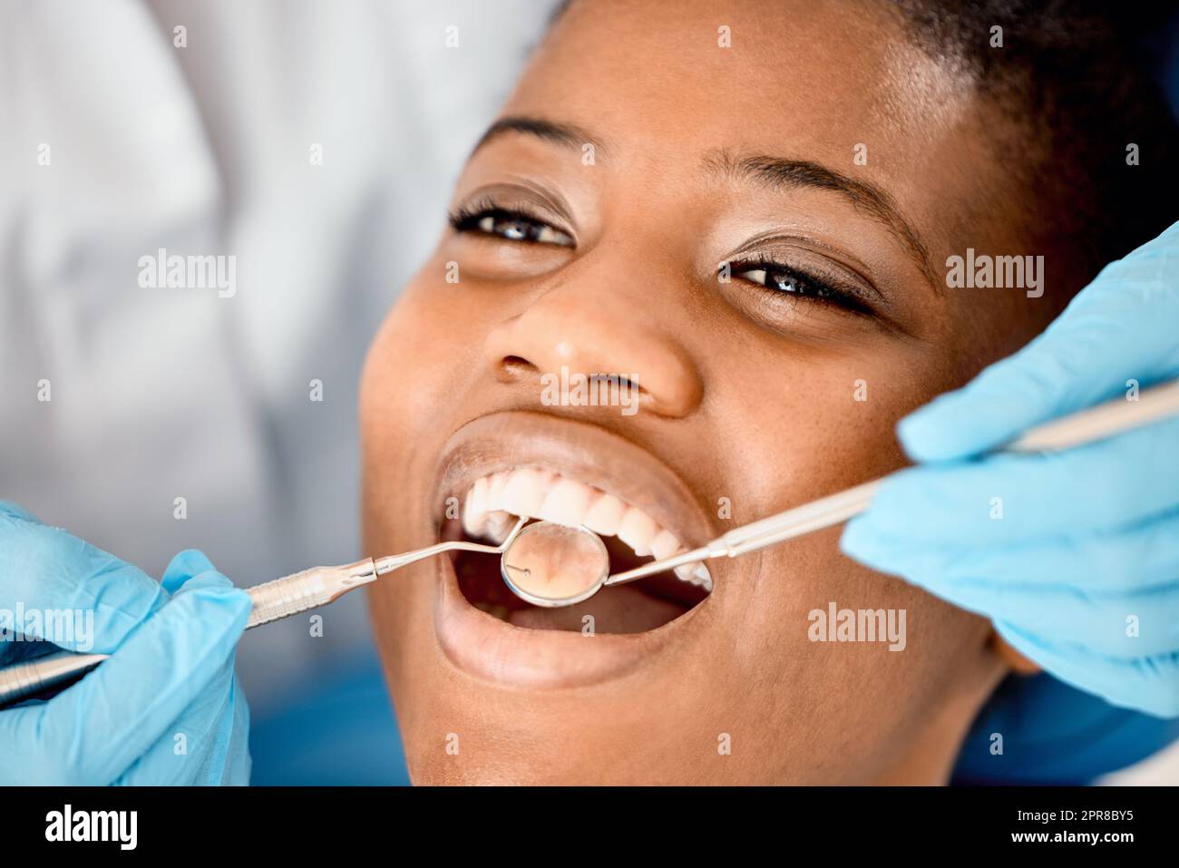 Aspetto rosa sano e fresco. Una giovane paziente femmina che ha i denti esaminati. Foto Stock