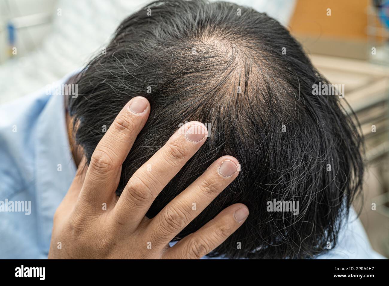 Calvo nella testa centrale e iniziare nessun capelli di perdita glabrous dell'uomo attivo maturo asiatico di ufficio intelligente di affari. Foto Stock
