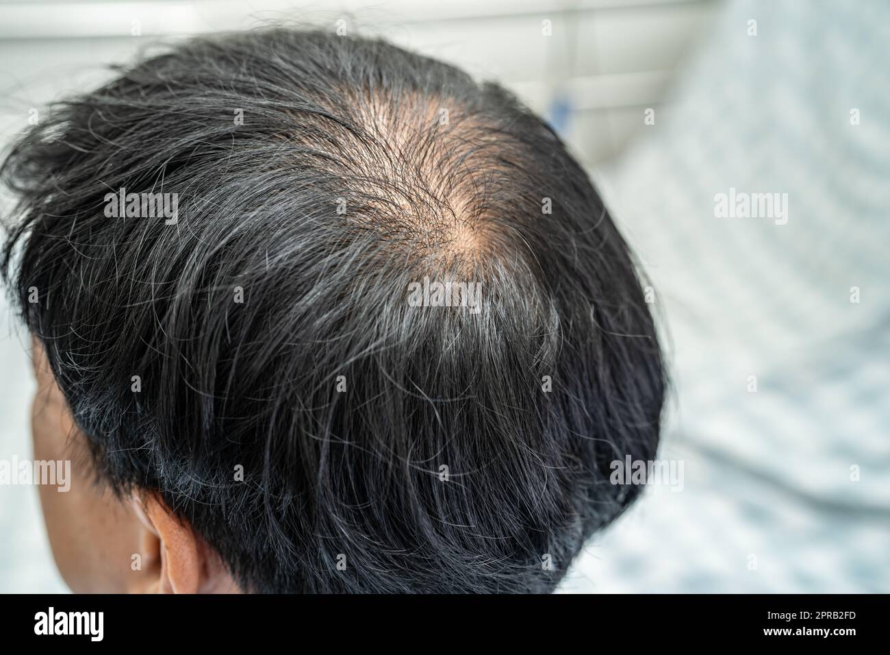 Calvo nella testa centrale e iniziare nessun capelli di perdita glabrous dell'uomo attivo maturo asiatico di ufficio intelligente di affari. Foto Stock