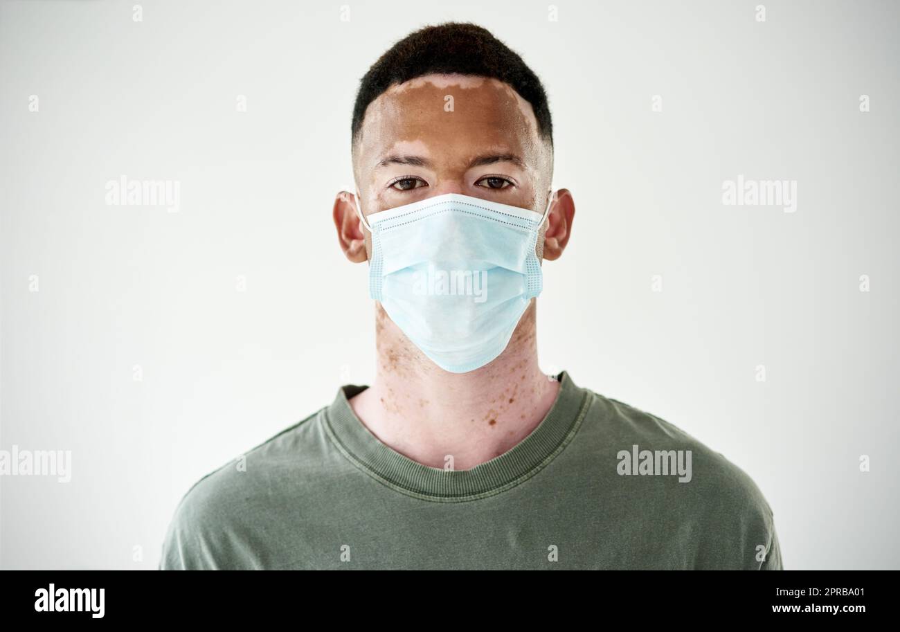 Le maschere sono una barriera semplice per aiutare a contenere la diffusione. Ritratto di studio di un giovane uomo con vitiligo che indossa una maschera su sfondo bianco. Foto Stock