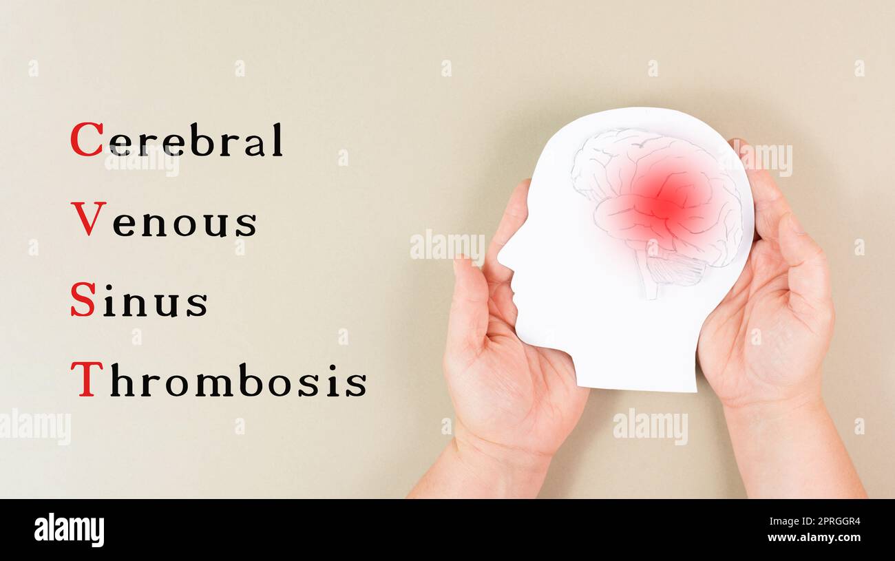 Trombosi venosa cerebrale del seno è in piedi sullo sfondo, Silhouette di una testa con un cervello, coagulo di sangue rosso, effetto collaterale vaccino covid-19 Foto Stock
