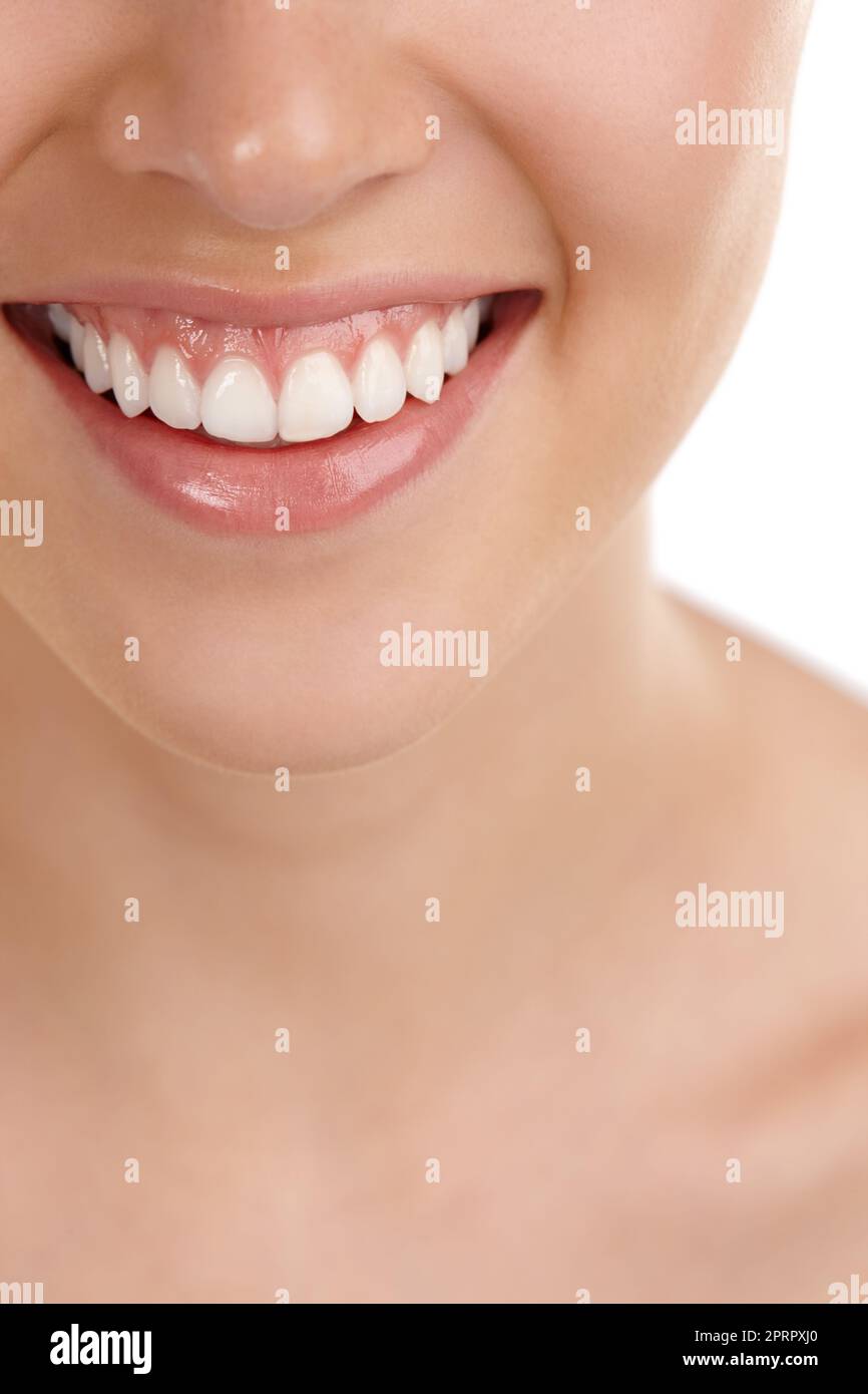 Bianchi perlacei. Primo piano di un giovane donna con un sorriso toothy su uno sfondo bianco. Foto Stock