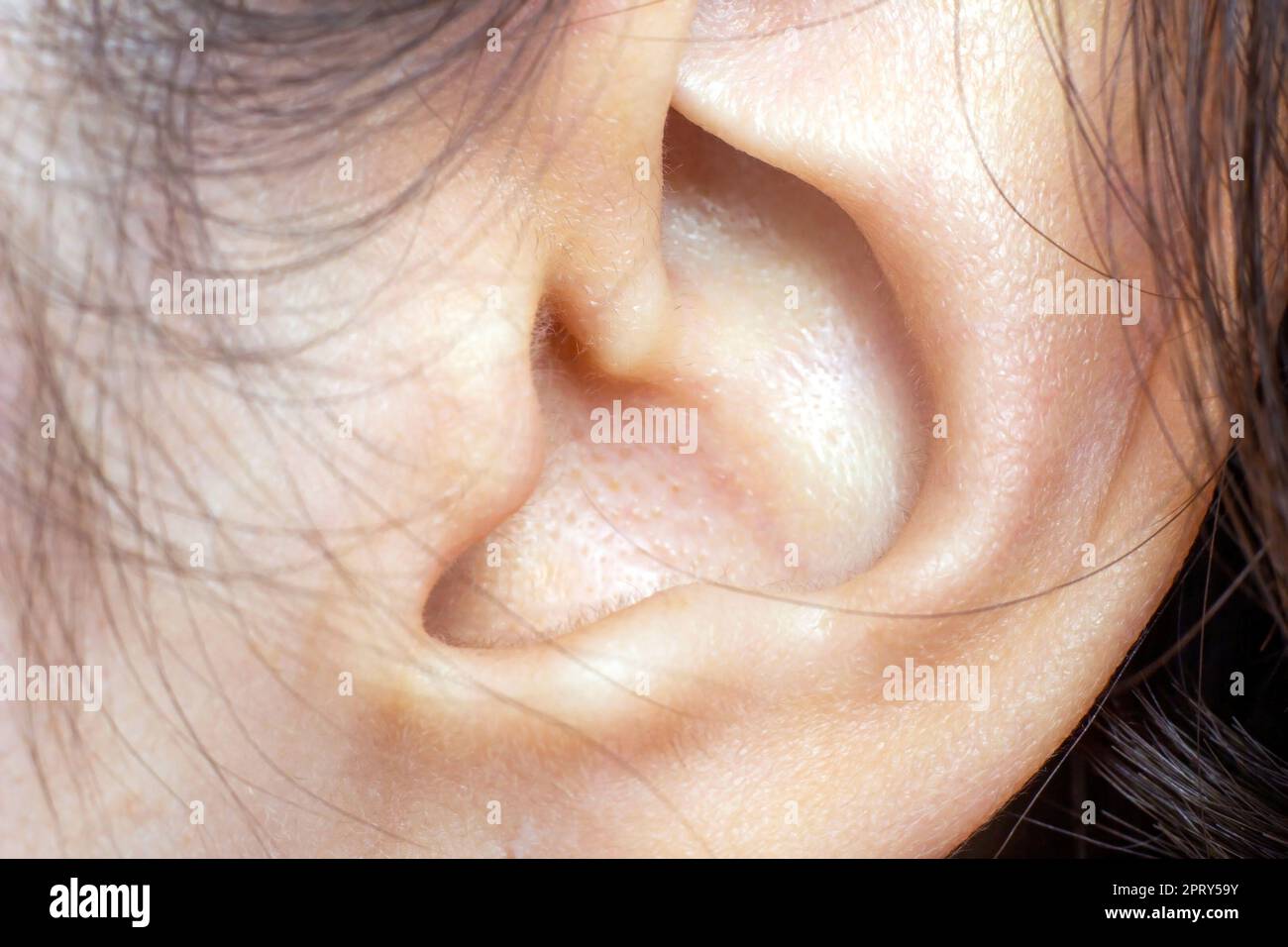 Dettaglio della testa con i capelli e l'orecchio umano femminile al primo piano di esame medico. Foto Stock