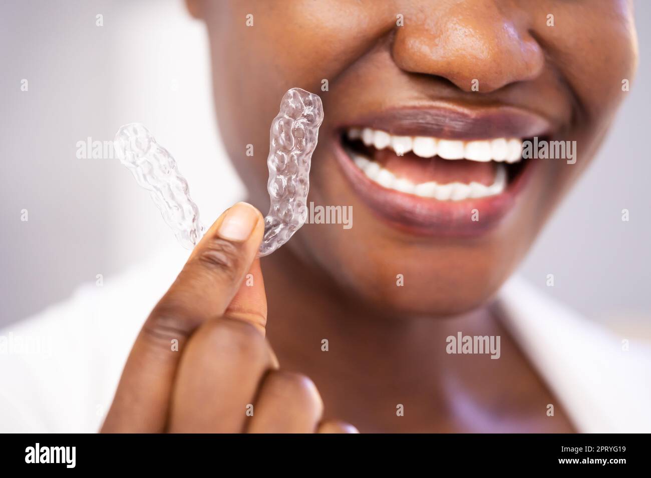 Cancellare la protezione notturna dentale dell'allineatore per i denti Foto  stock - Alamy