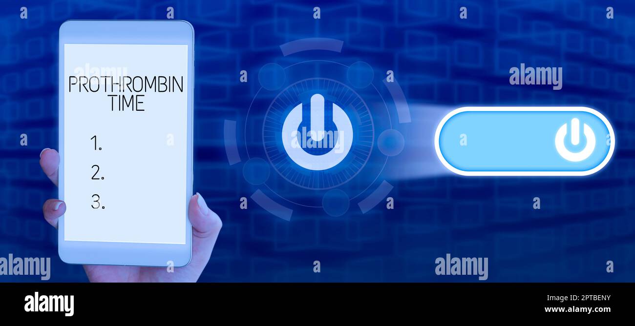 Didascalia concettuale tempo di protrombina, concetto che significa stato del rapporto tra il pubblico e un'azienda Foto Stock