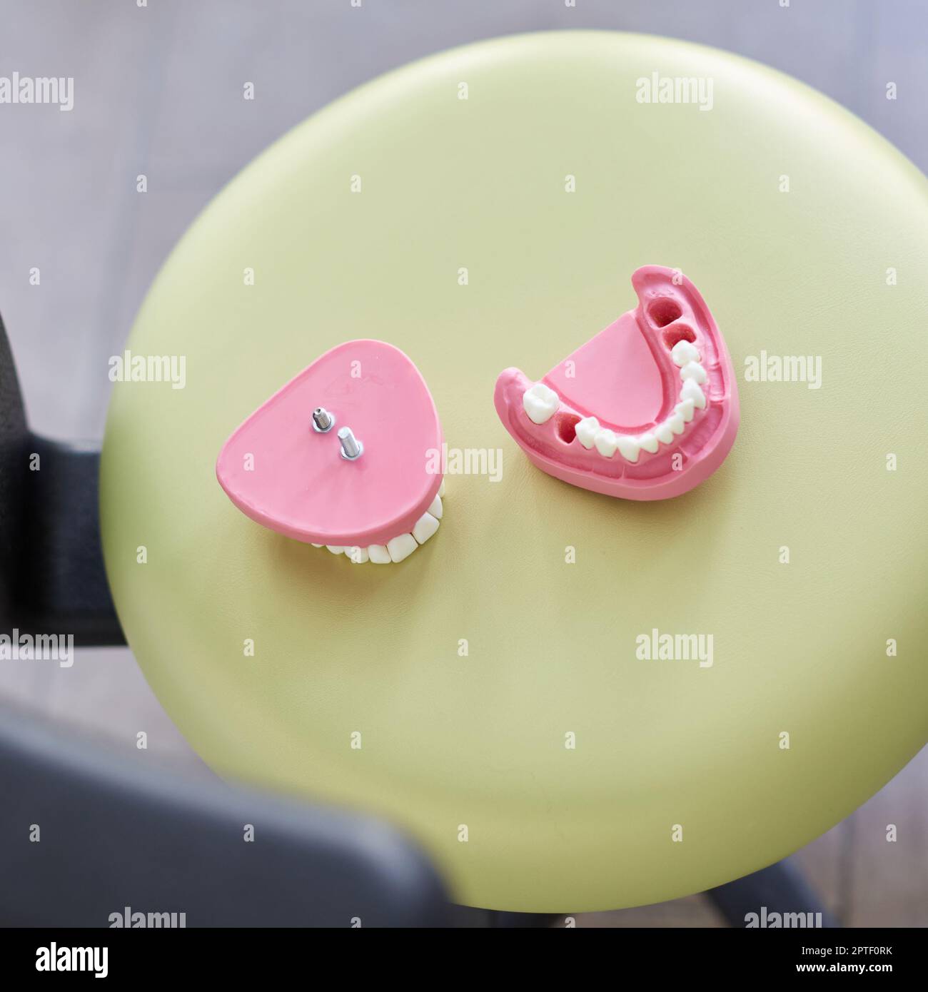 Odontoiatria estetica. Primo piano del modello dentario in gesso rosa dei denti umani che il medico presenterà al paziente. Vista dall'alto del modello di ganascia senza diverse te Foto Stock