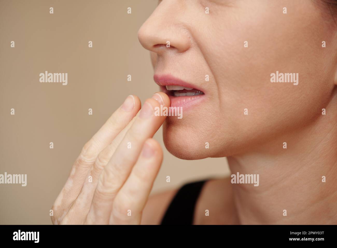 Donna matura che applica balsamo nutriente sulle labbra secche Foto Stock