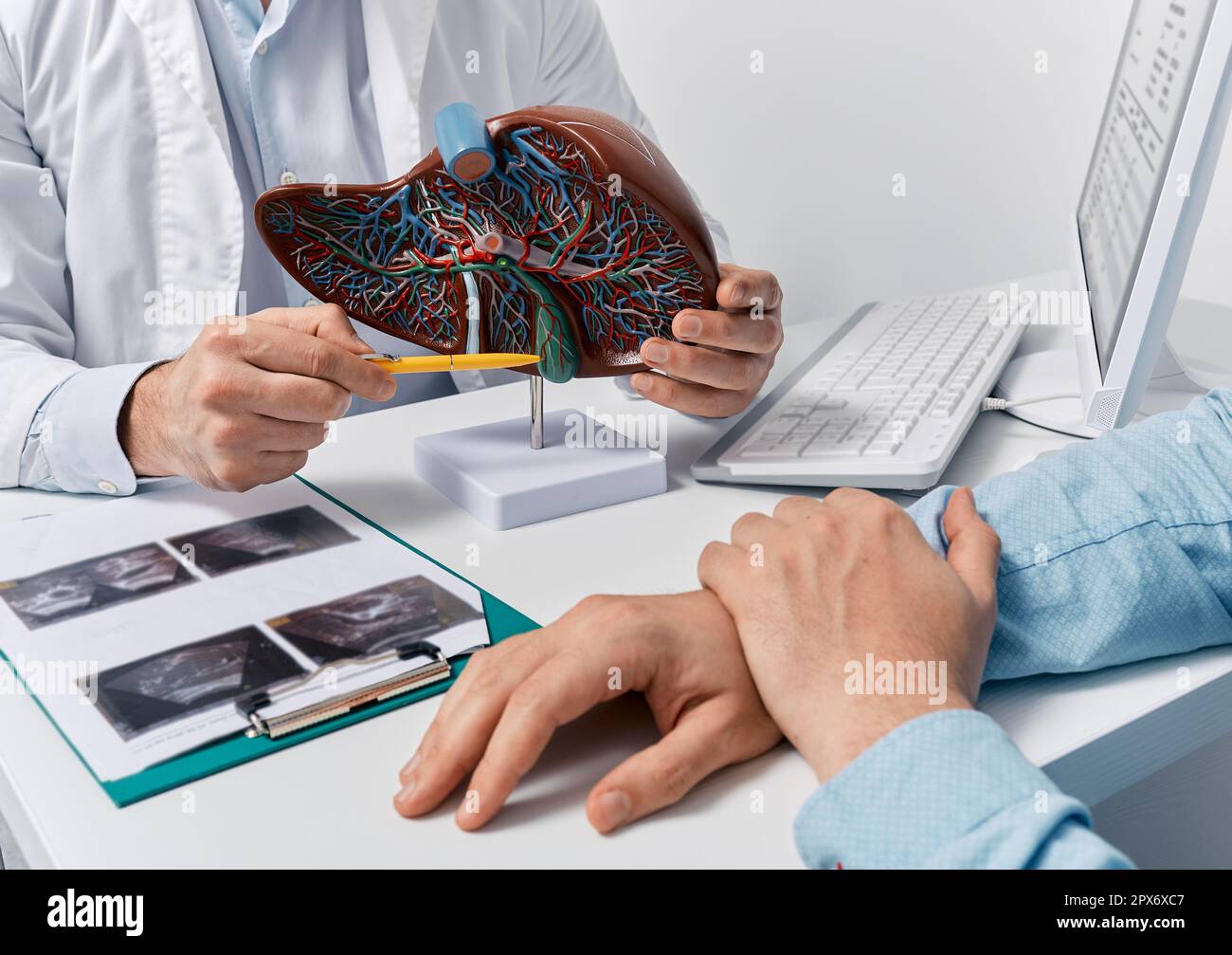 Modello di fegato umano sul tavolo del medico, primo piano. Trattamento dell'epatite, della cirrosi e del cancro al fegato Foto Stock