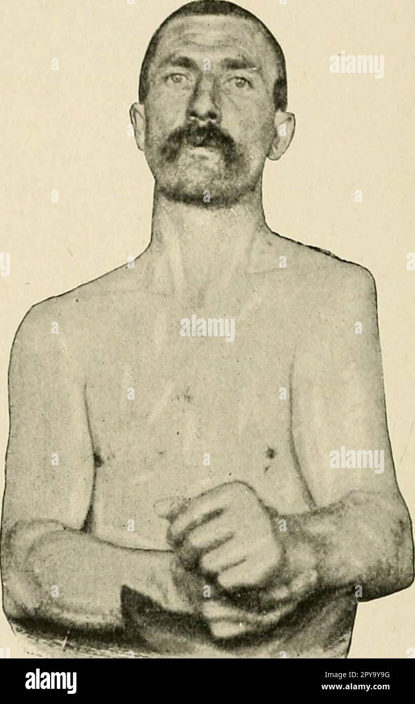 "Un libro di testo di pronto soccorso e di trattamento d'urgenza" (1917) Foto Stock