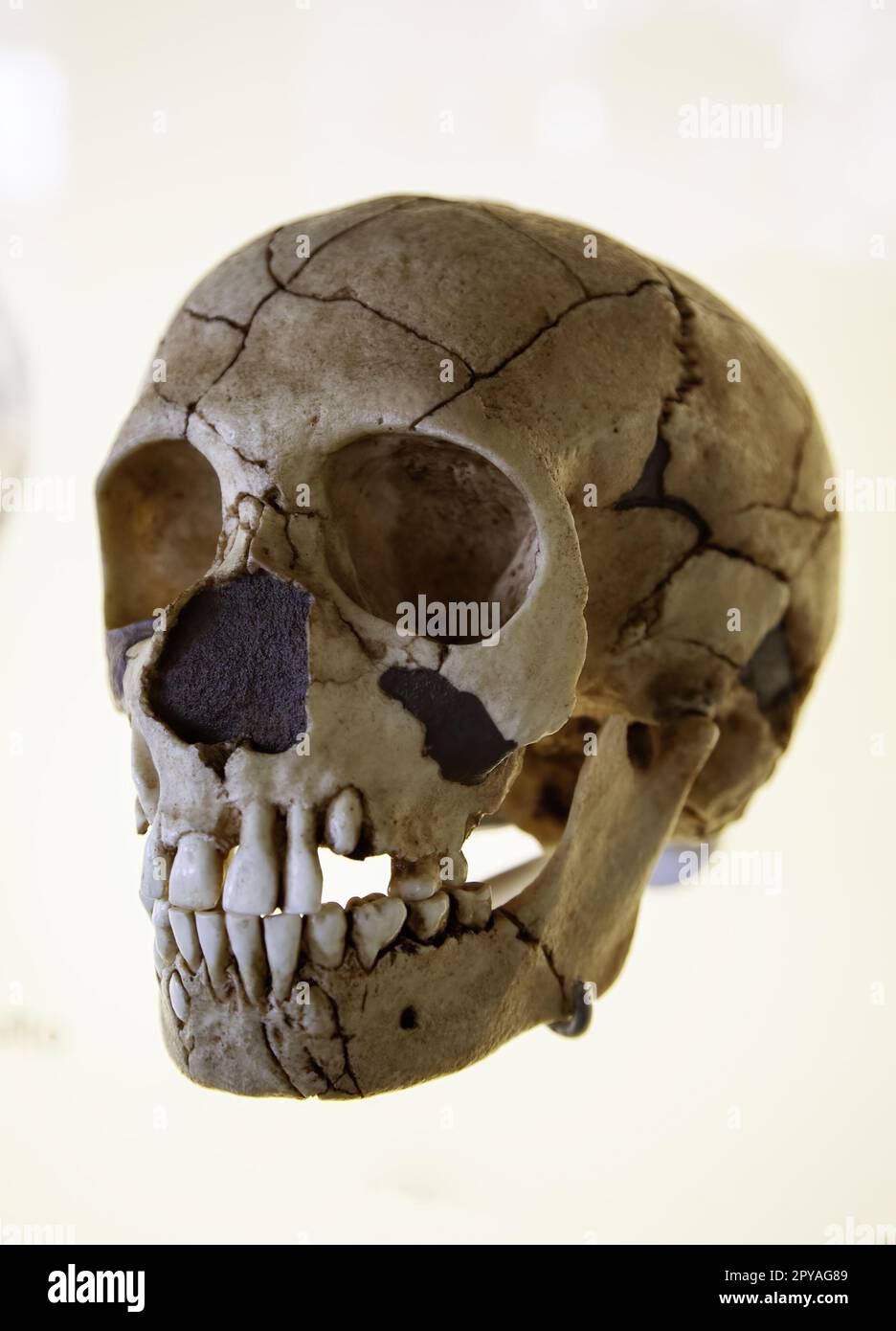 Cranio umano preistorico Foto Stock