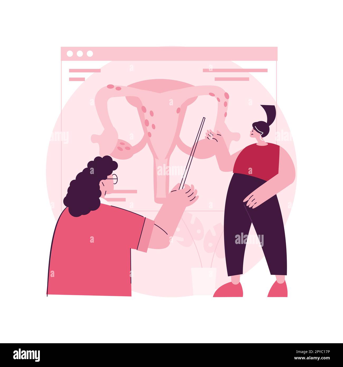 Illustrazione vettoriale del concetto astratto di endometriosi. Disfunzionalità dell'endometrio, clinica ginecologica, diagnosi e trattamento dell'endometriosi, metafora astratta della funzione riproduttiva femminile. Illustrazione Vettoriale