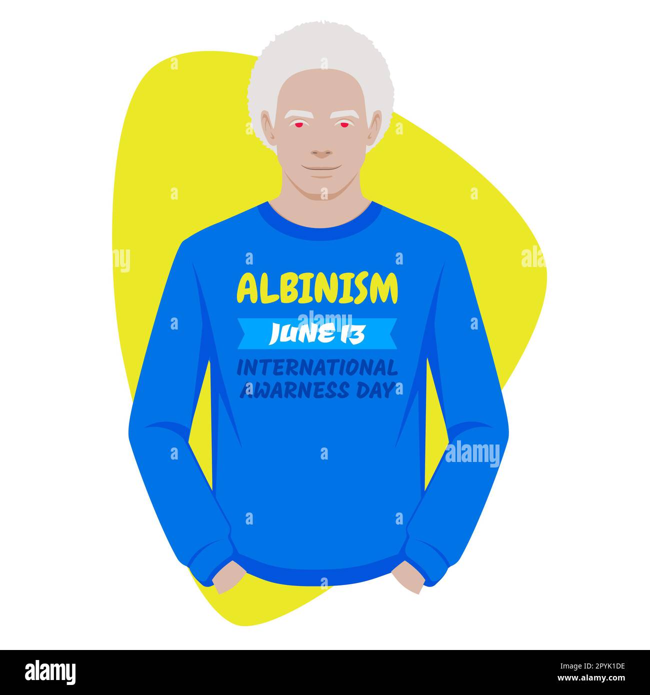 Albino, uomini e donne con albinismo. Illustrazione digitale dell'ereditarietà recessiva in cui entrambi i genitori portano il gene dell'albinismo anomalo Internat Foto Stock