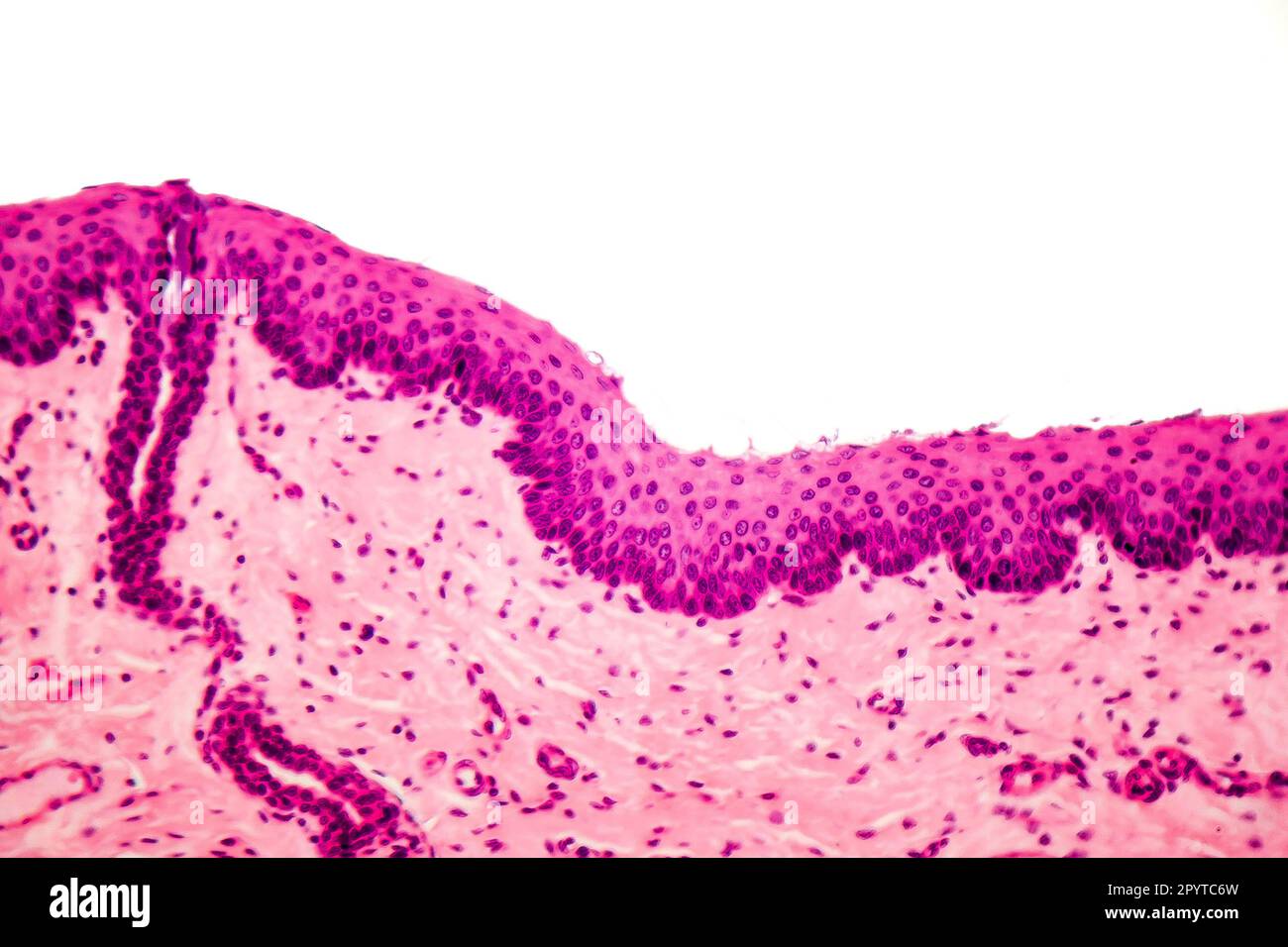 Epitelio squamoso stratificato umano al microscopio, micrografia leggera Foto Stock