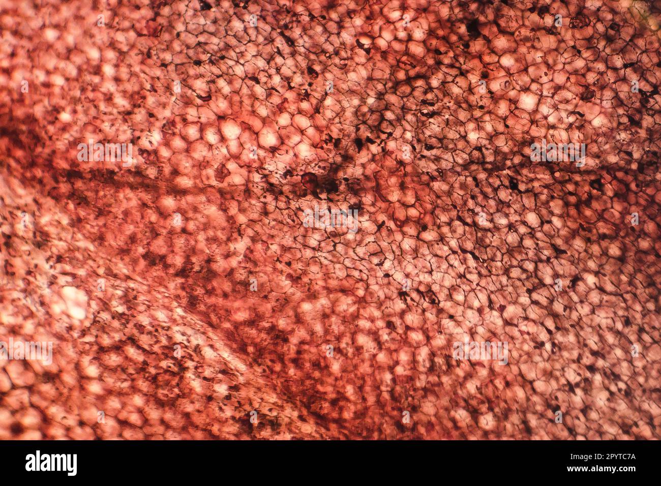Epitelio squamoso semplice umano sotto il microscopio, fotomicrografia leggera Foto Stock