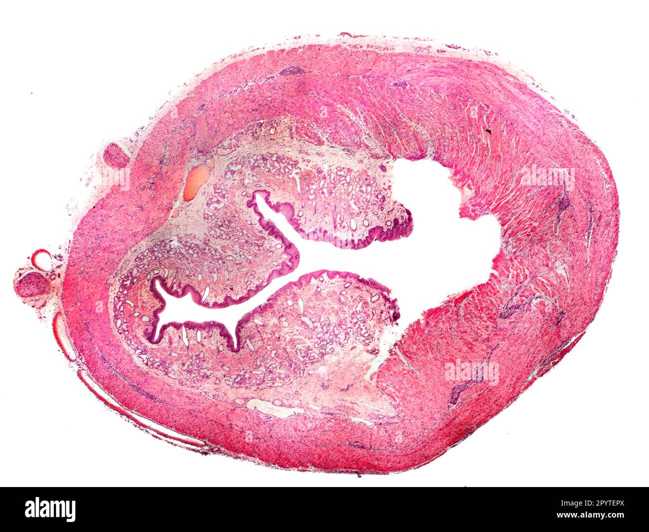 Sezione trasversale dell'esofago umano, isolata su sfondo bianco. Micrografia leggera Foto Stock