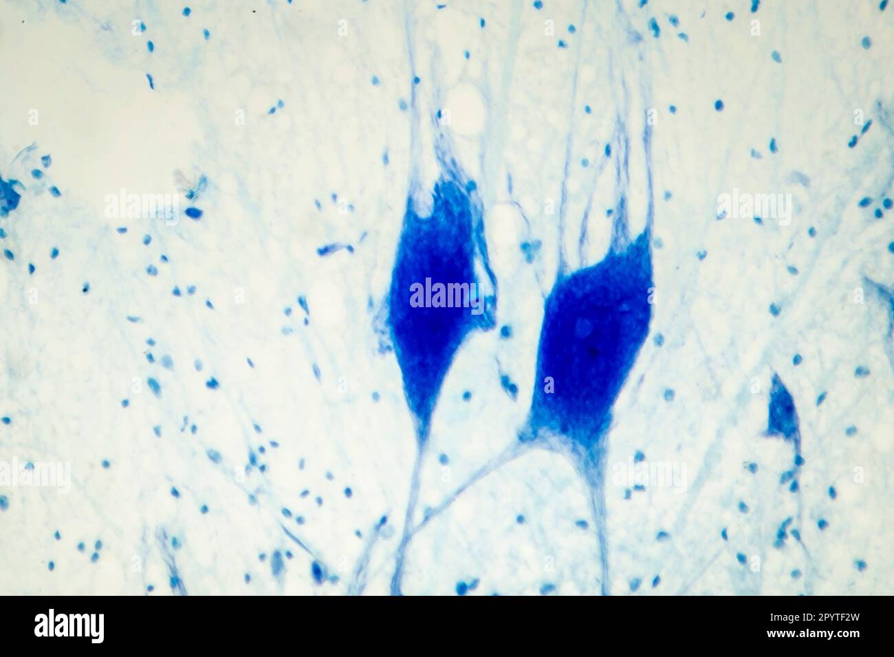 Micrografia leggera del tessuto cerebrale umano che mostra neuroni e cellule gliali Foto Stock