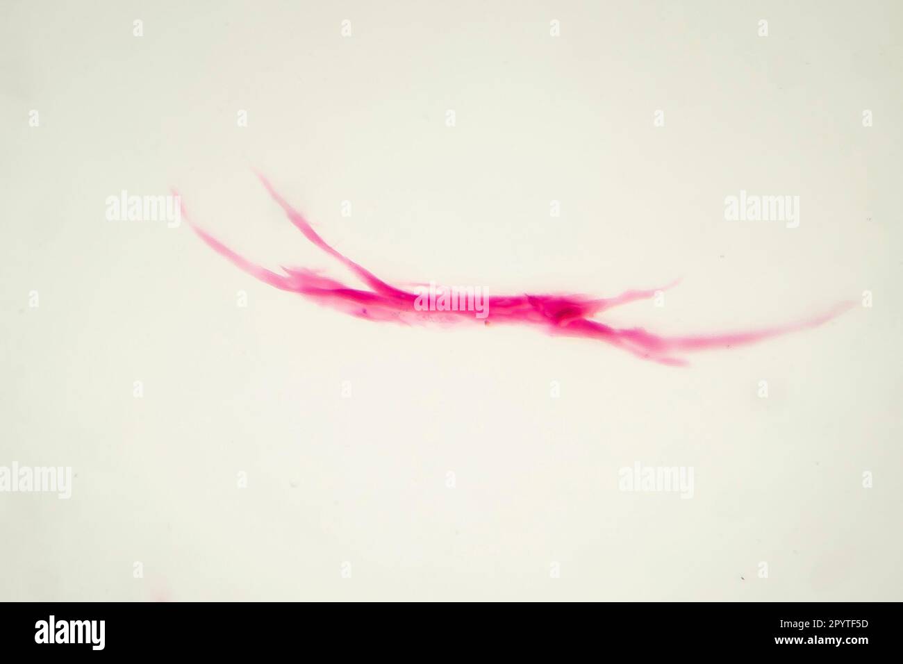 Teased umano liscio fibra muscolare, micrografia leggera Foto Stock