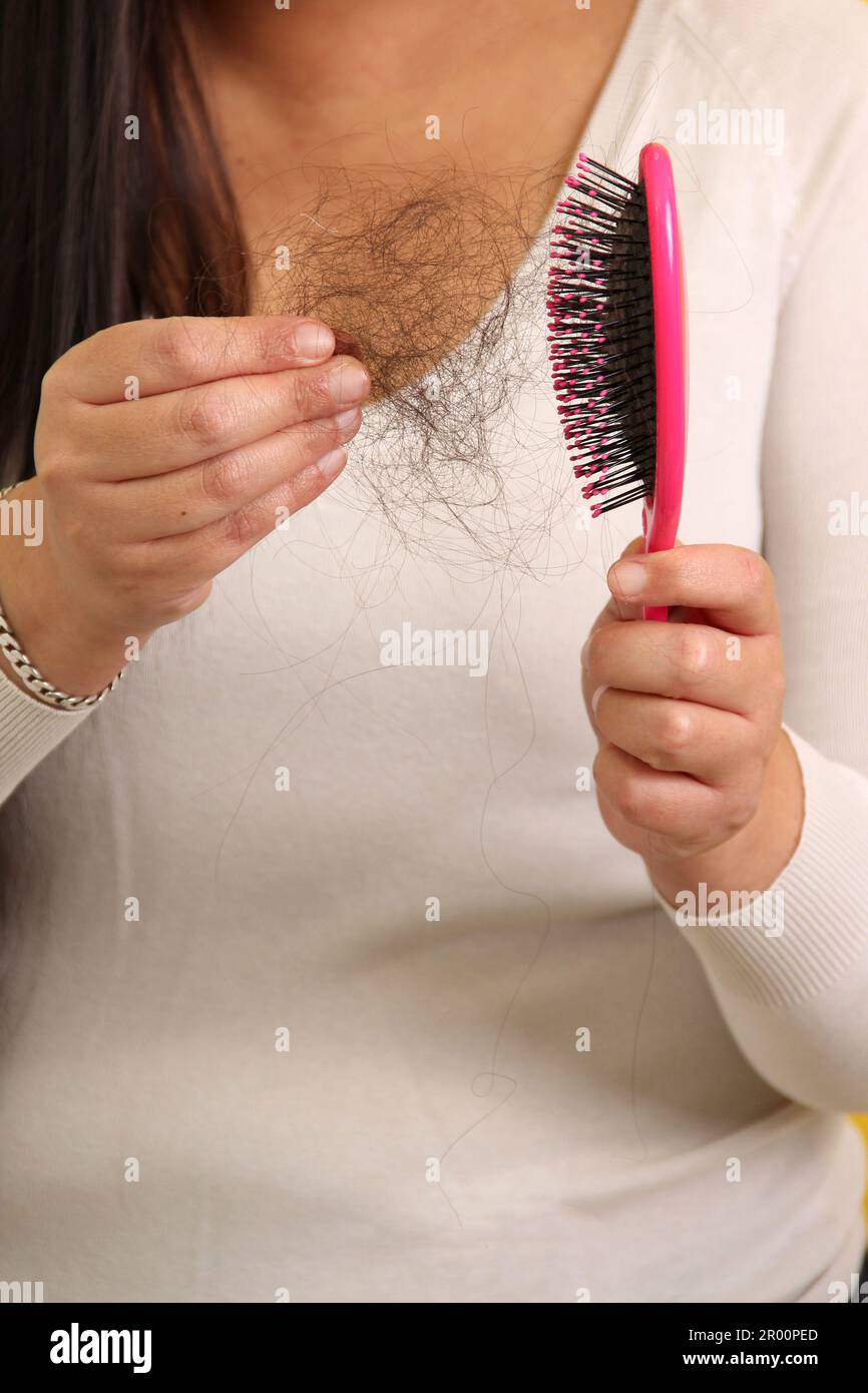 Le mani della donna prendono una spazzola dei capelli con molti capelli caduti dopo la spazzolatura per alopesia, anemia o malattia del postpartum Foto Stock