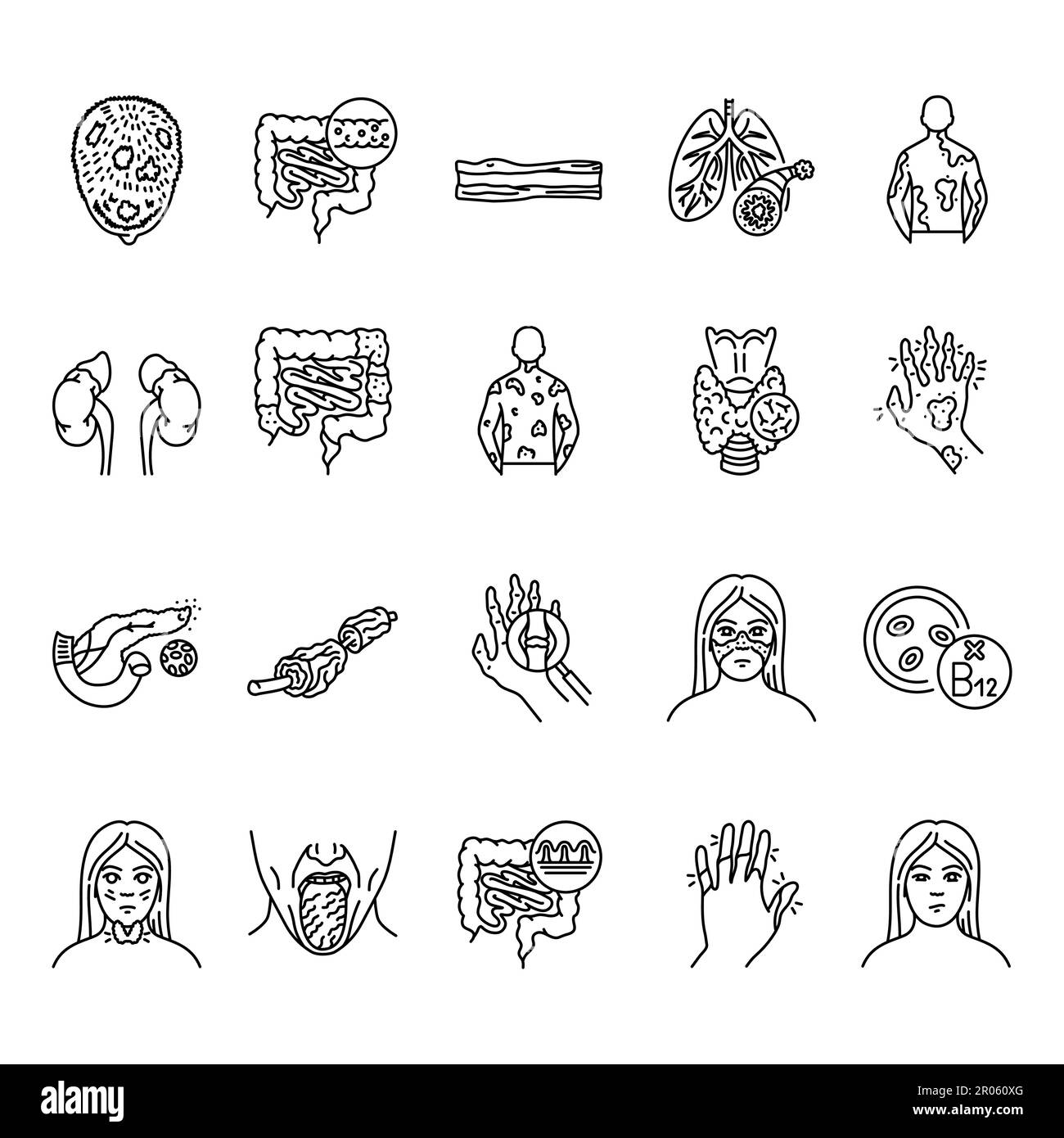 Set di icone linea nera per malattie autoimmuni. Pittogrammi per pagina Web, app mobile, promo. Illustrazione Vettoriale
