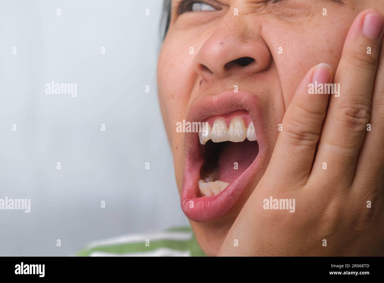 Donna asiatica che tiene la mano sulla guancia sensazione di mal di denti, carie dentali, gengivite o mal di alito problema. Concetto di mal di denti e salute orale. Foto Stock