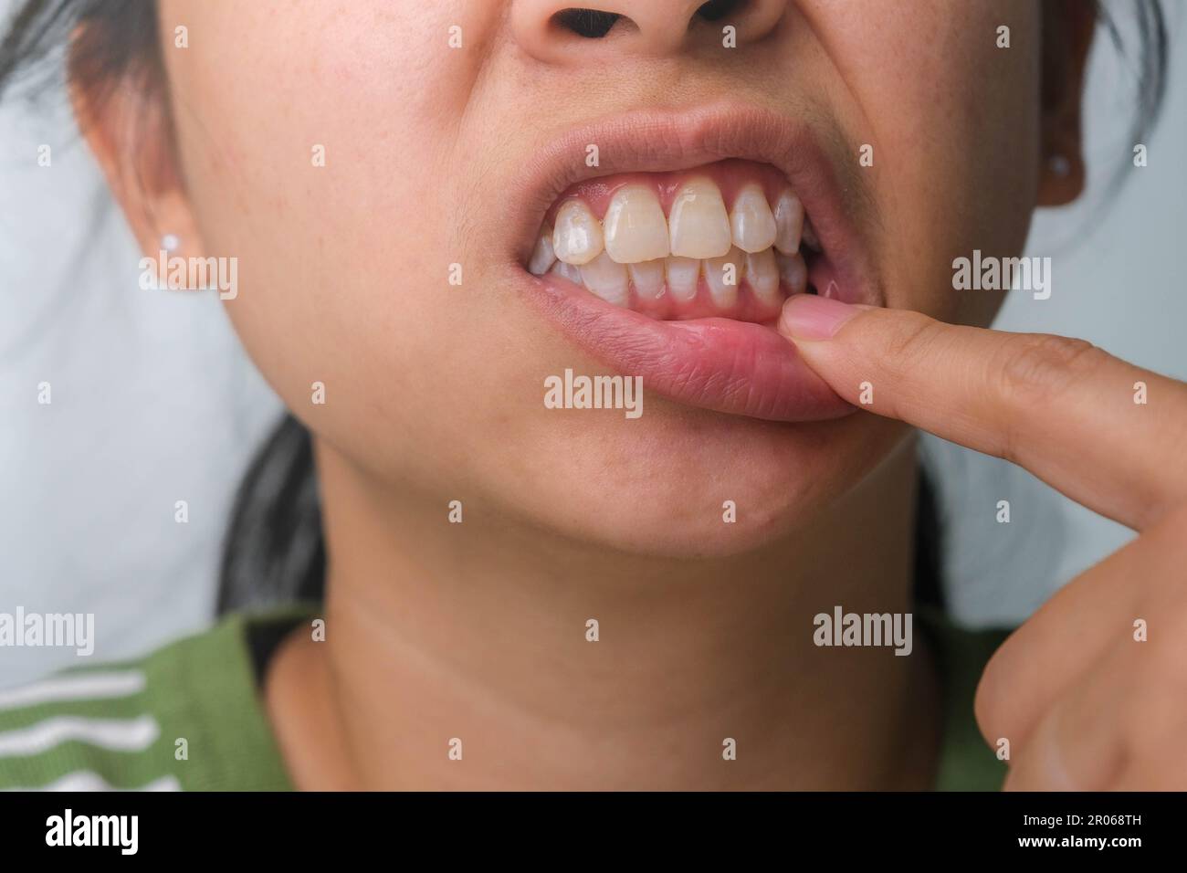 Donna asiatica che tiene la mano sulla guancia sensazione di mal di denti, carie dentali, gengivite o mal di alito problema. Concetto di mal di denti e salute orale. Foto Stock
