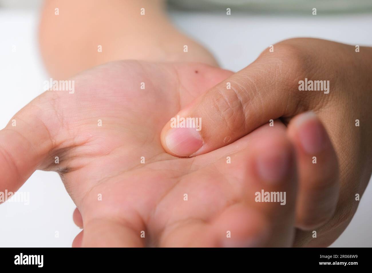 Donna con dolore al polso, intorpidimento o sindrome del tunnel carpale, artrite, malattia neurologica. Primo piano della mano della donna che tiene un'articolazione dolorosa. Foto Stock