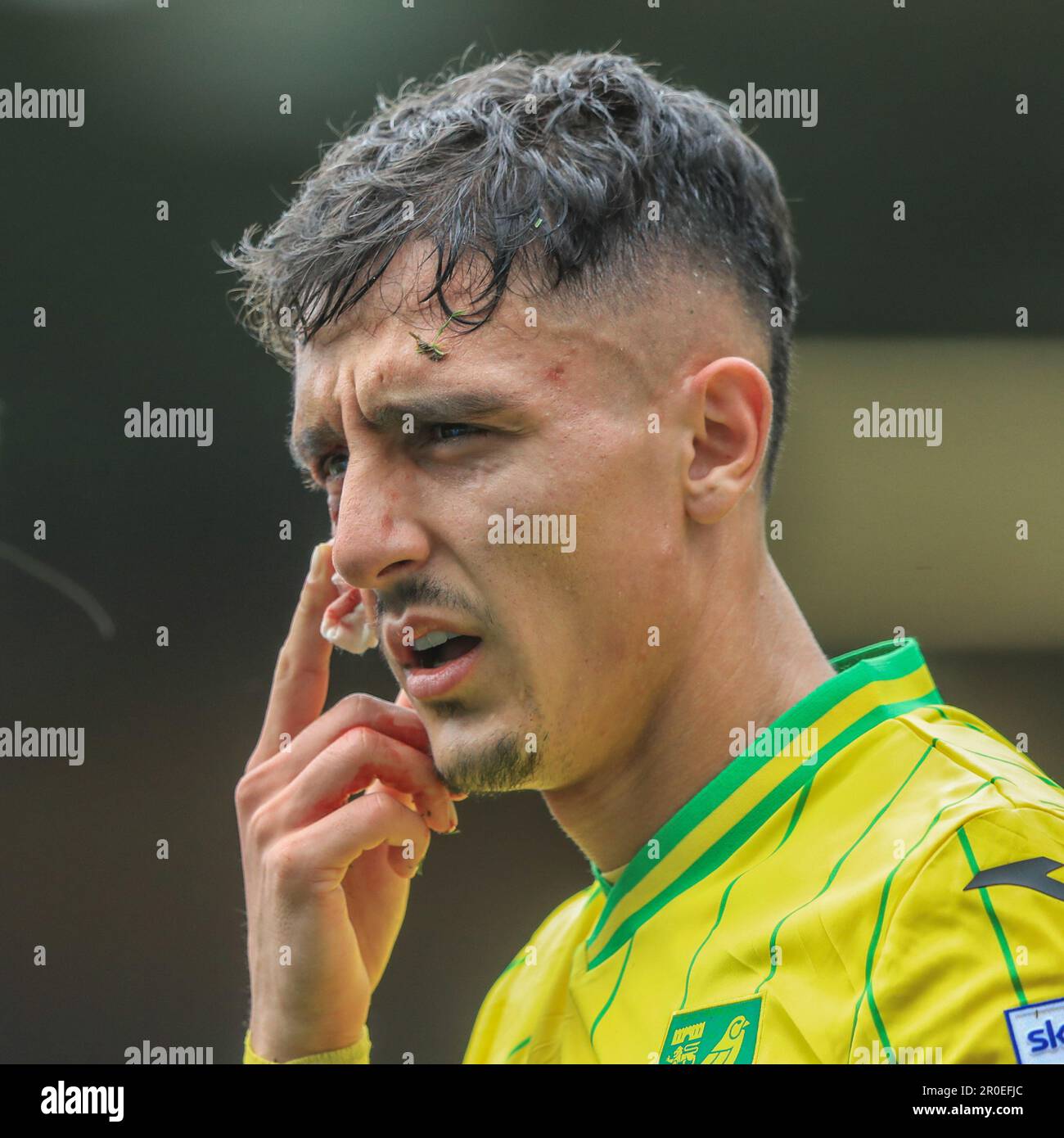 Dimitris Giannoulis #30 di Norwich City riceve un taglio alla guancia durante la partita di campionato Sky Bet Norwich City vs Blackpool a Carrow Road, Norwich, Regno Unito, 8th maggio 2023 (Foto di Alfie Cosgrove/News Images) Foto Stock