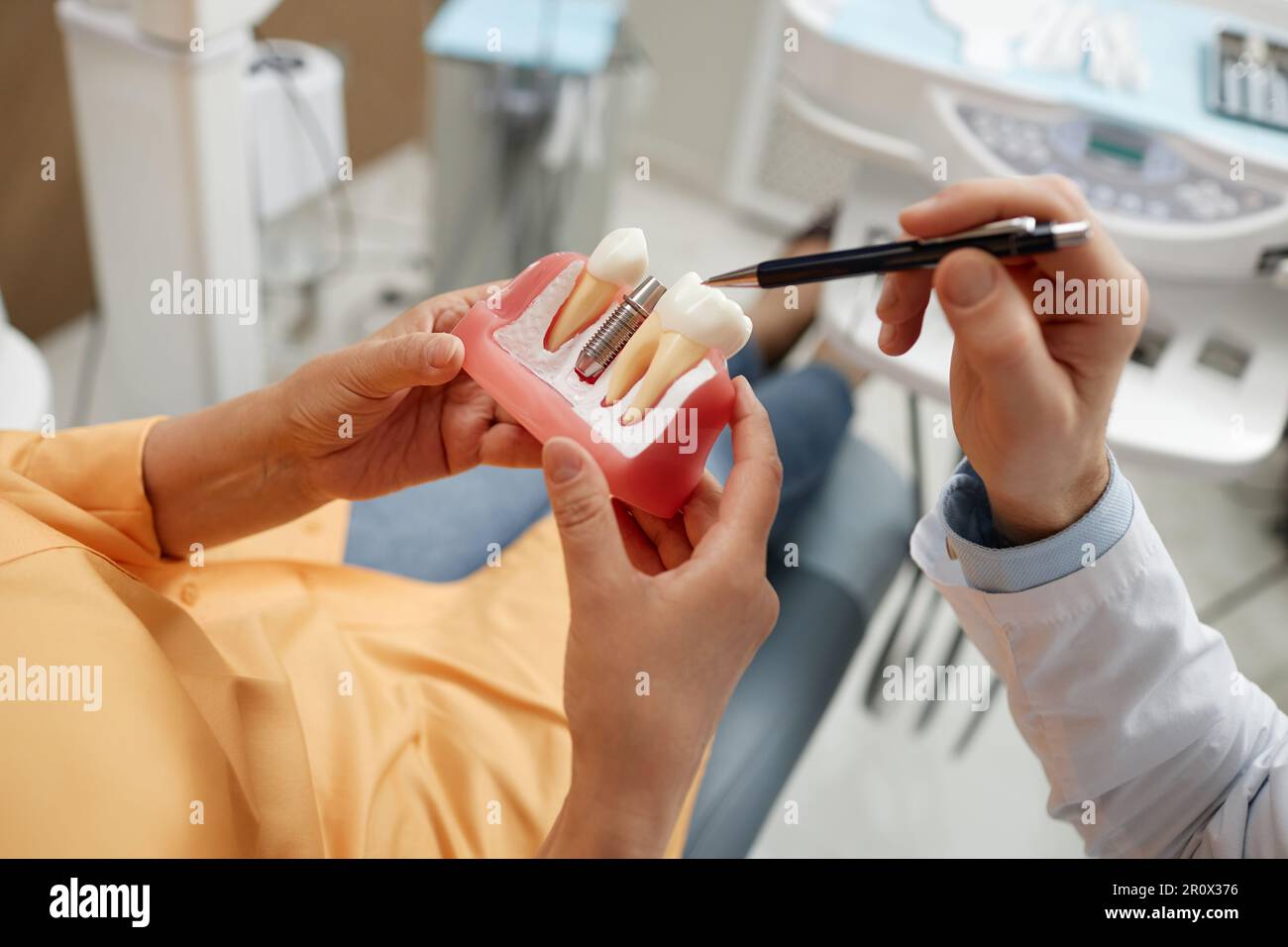 Primo piano di una donna anziana irriconoscibile che tiene il modello del dente durante la consultazione sulla chirurgia implantare dentale in clinica dentale Foto Stock