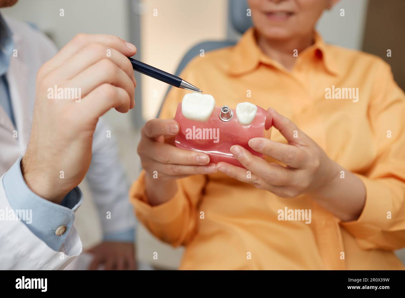 Primo piano di un dentista irriconoscibile che indica il modello del dente mentre spiega la chirurgia implantare dentale al paziente in clinica Foto Stock