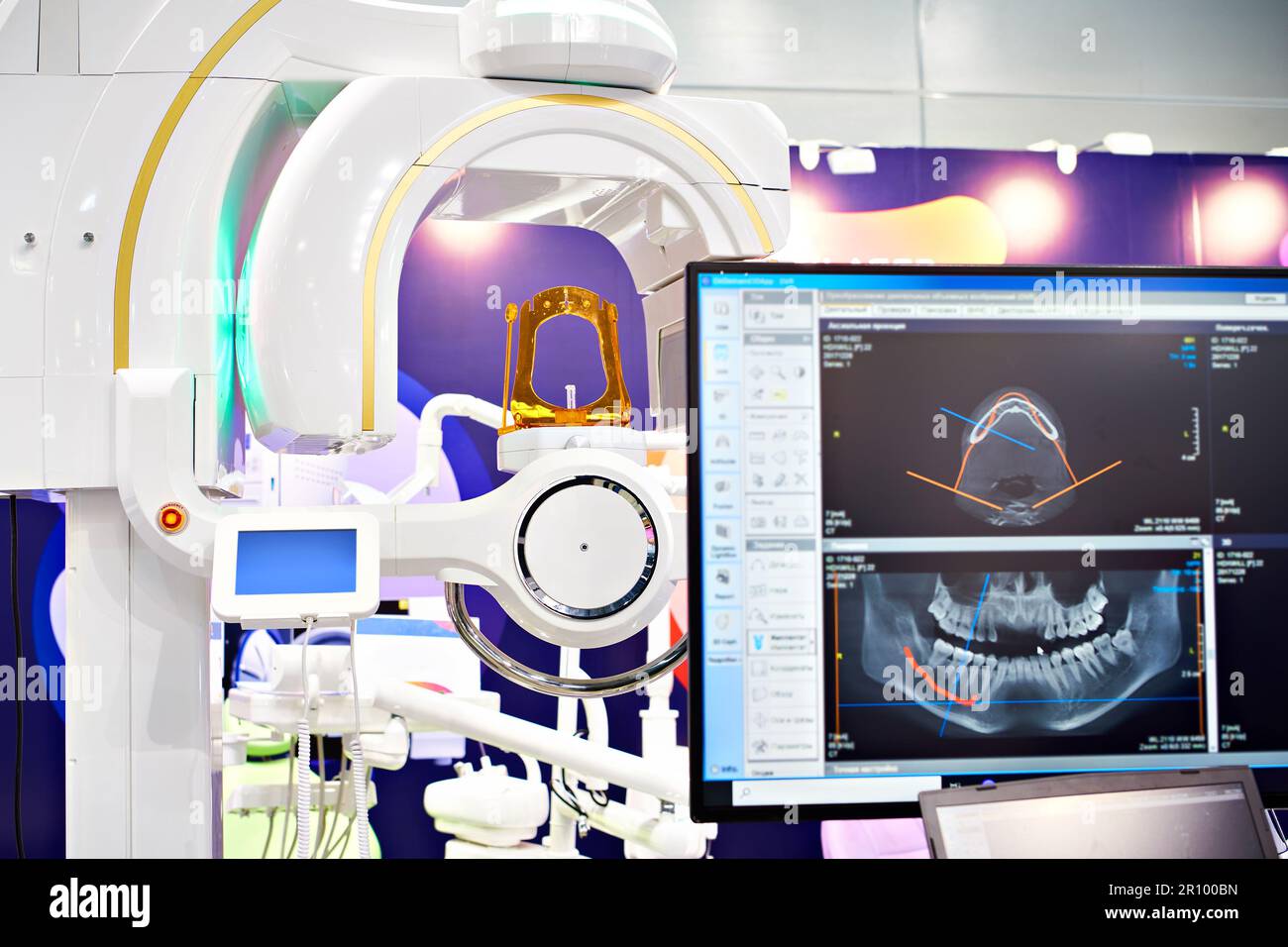 Moderno tomografo dentale digitale 3D Foto Stock