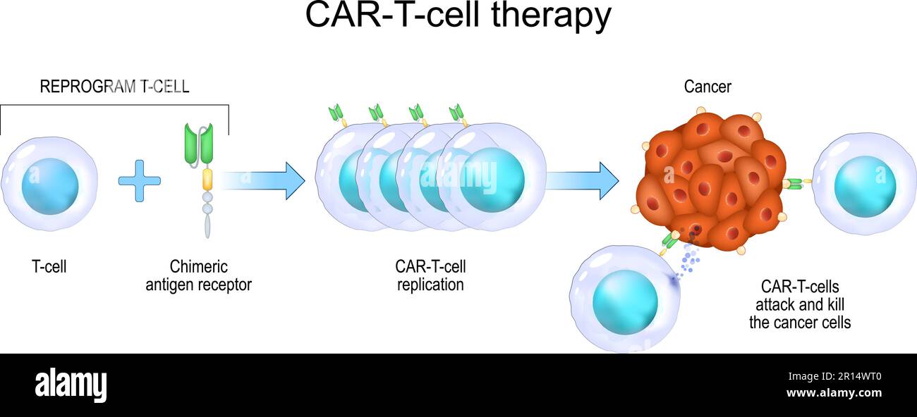 Terapia DELLE cellule T DELL'AUTOMOBILE. immunoterapia del cancro. uccisione di cellule tumorali. ingegneria genetica. Medicina personalizzata. Illustrazione vettoriale Illustrazione Vettoriale