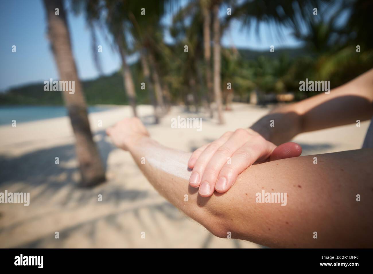 Primo piano della mano durante l'applicazione della crema solare. Cura della pelle durante le vacanze estive sulla bella spiaggia di sabbia con palme in una destinazione tropicale. Foto Stock
