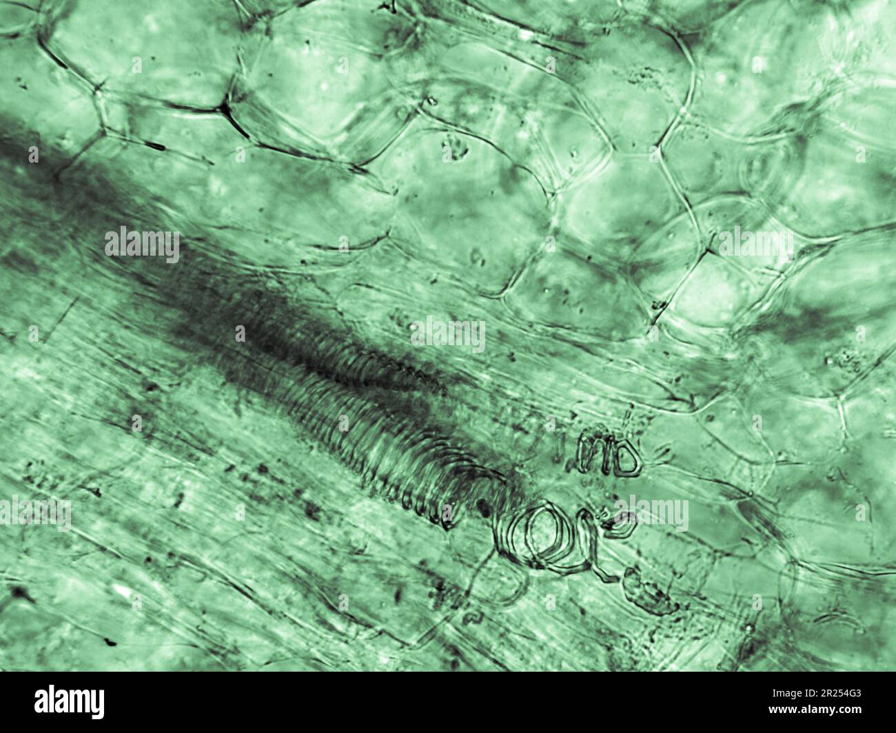 Struttura delle cellule di squash e delle spirali osservata al microscopio ottico biologico. Colorato per una migliore esperienza artistica e per aumentare la visibilità e il contrasto Foto Stock