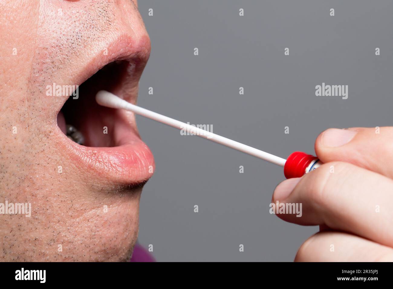 DNA, test DNS, test di cancellazione Foto Stock