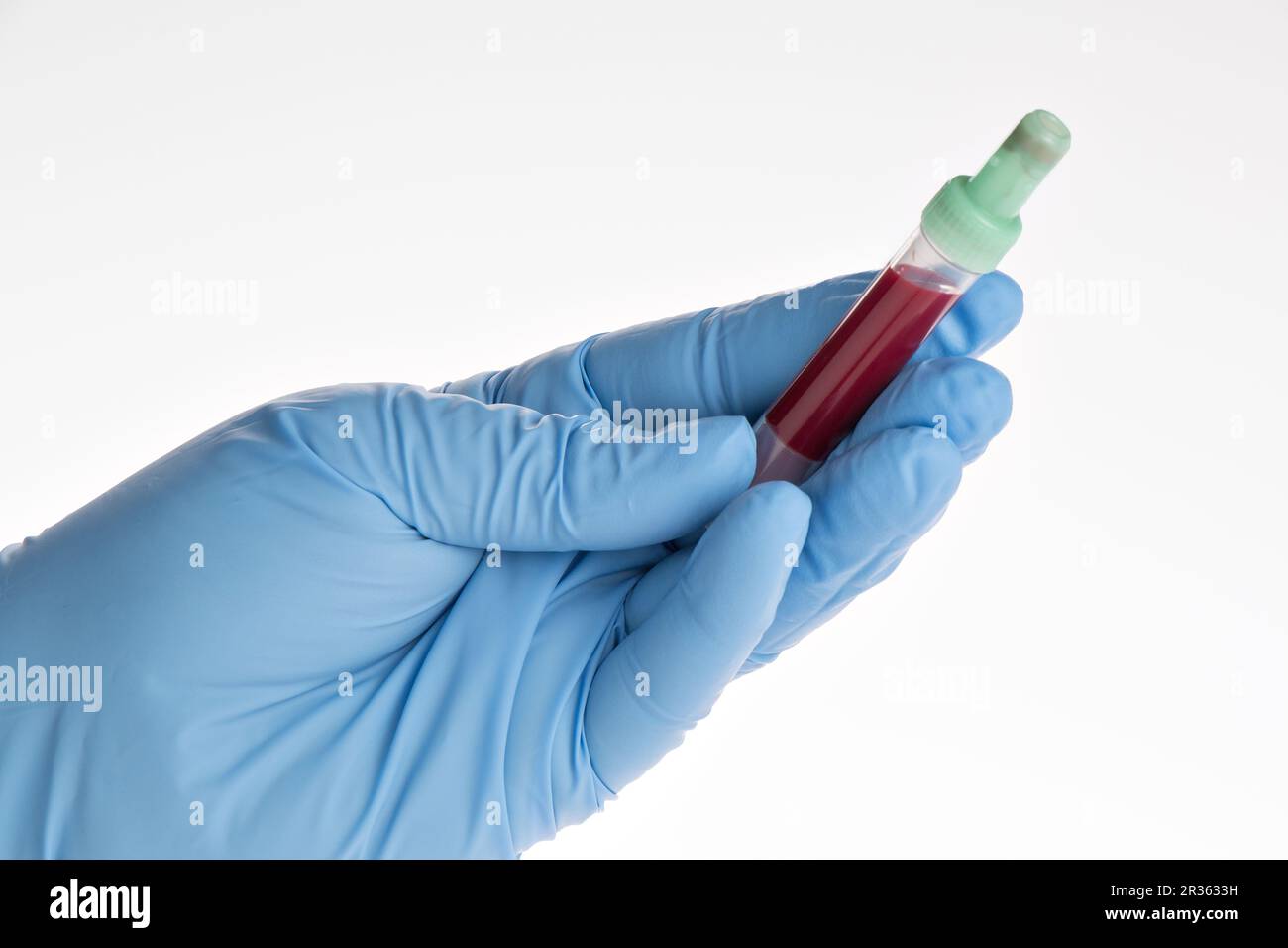 Analisi del sangue, campioni di sangue su un modulo di laboratorio Foto Stock