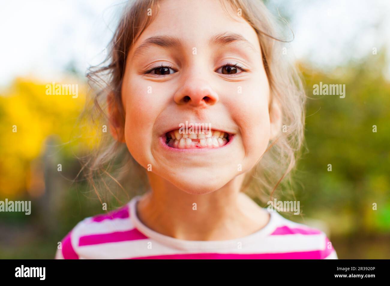 Ragazza sorridente che mostra il primo dente permanente che viene in su Foto Stock