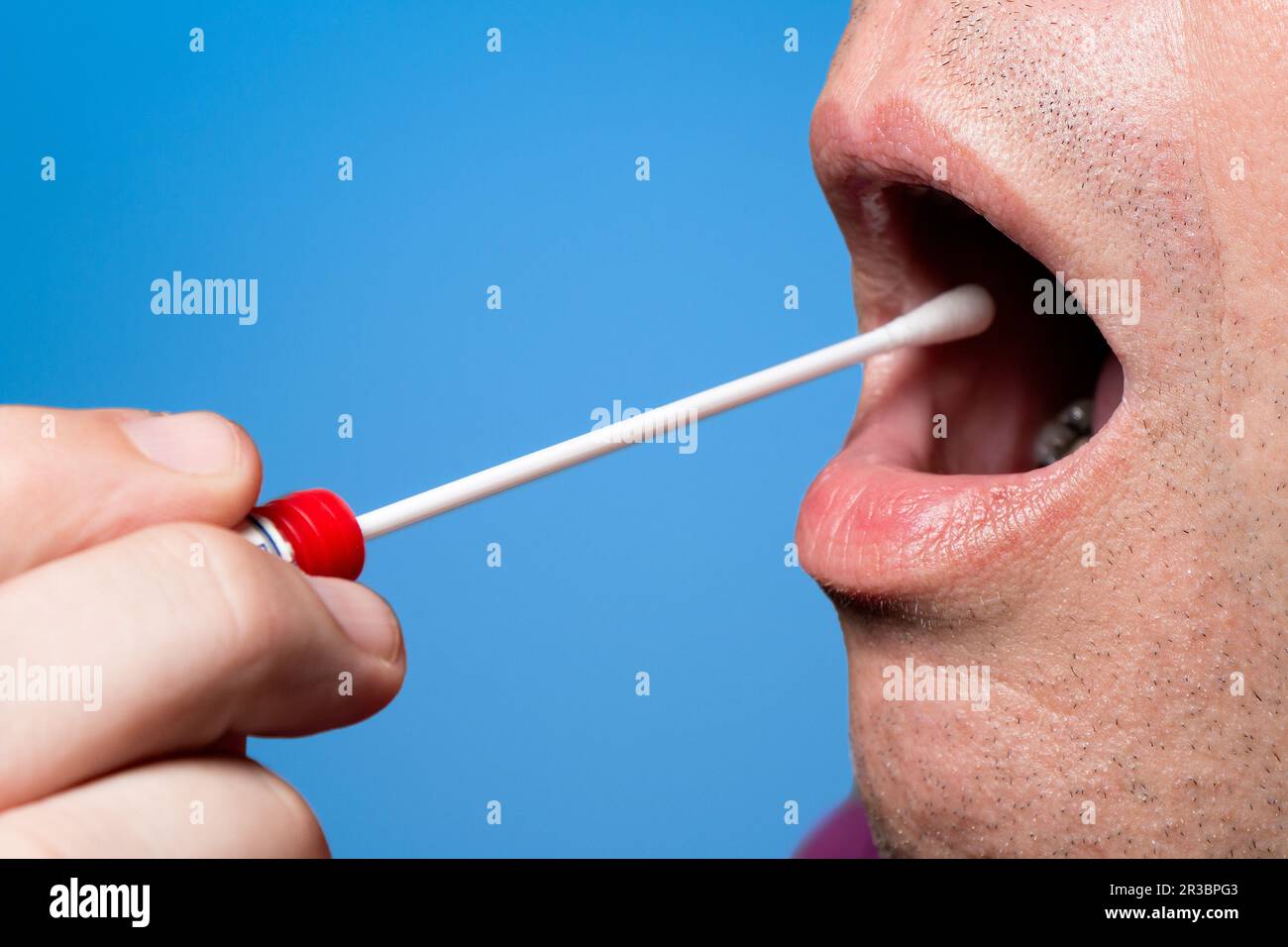 DNA, test DNS, test di cancellazione Foto Stock