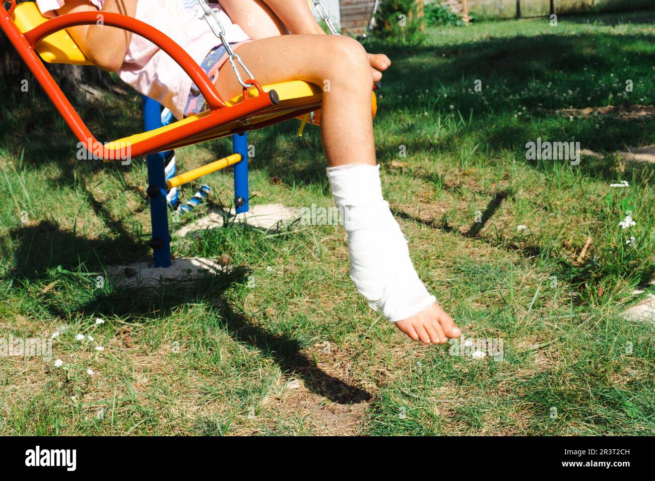 Le gambe dei bambini sono fasciate in gesso - a piedi nudi su un altalena. Attrezzature traumatiche, lesioni ai bambini, lividi, spruzzo, frattura Foto Stock