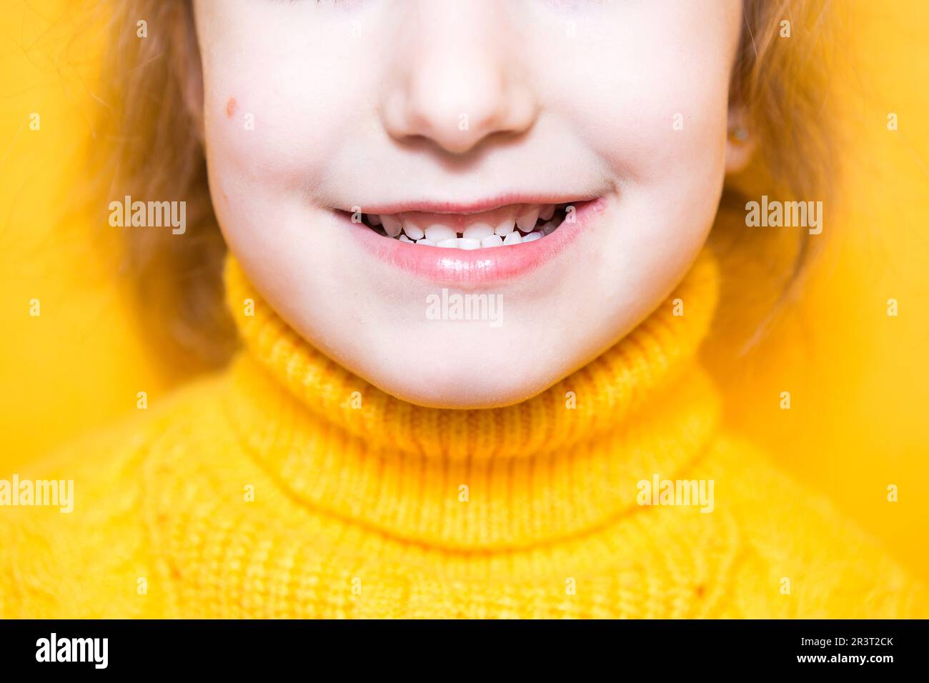 La ragazza mostra i suoi denti-morso patologico, malocclusione, overbite. Odontoiatria pediatrica e periodontica, correzione del morso. Salute An Foto Stock